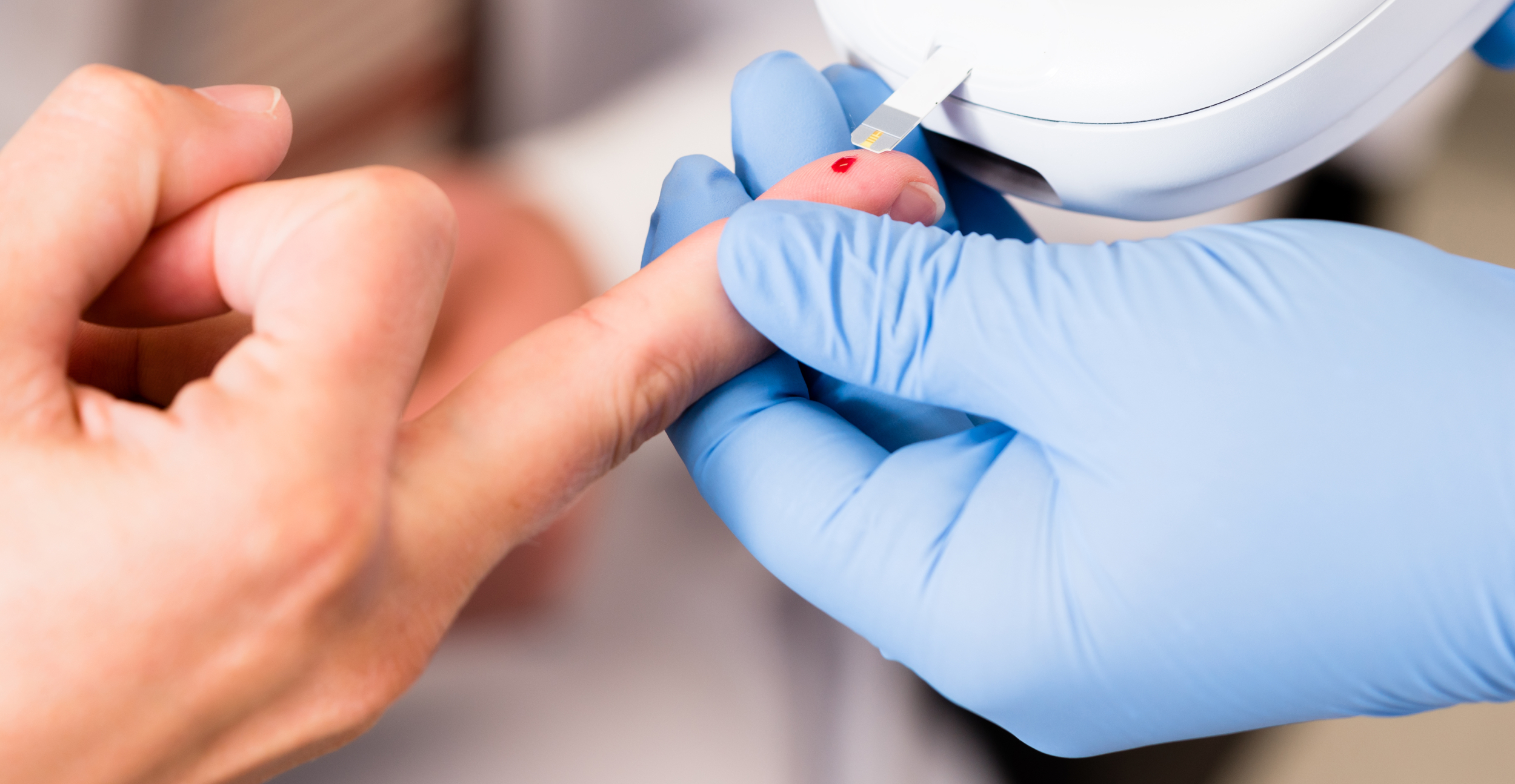 A drop of blood is taken from the fingertip for rapid analysis with a test strip – typically for point-of-care analysis or self-testing of blood sugar.