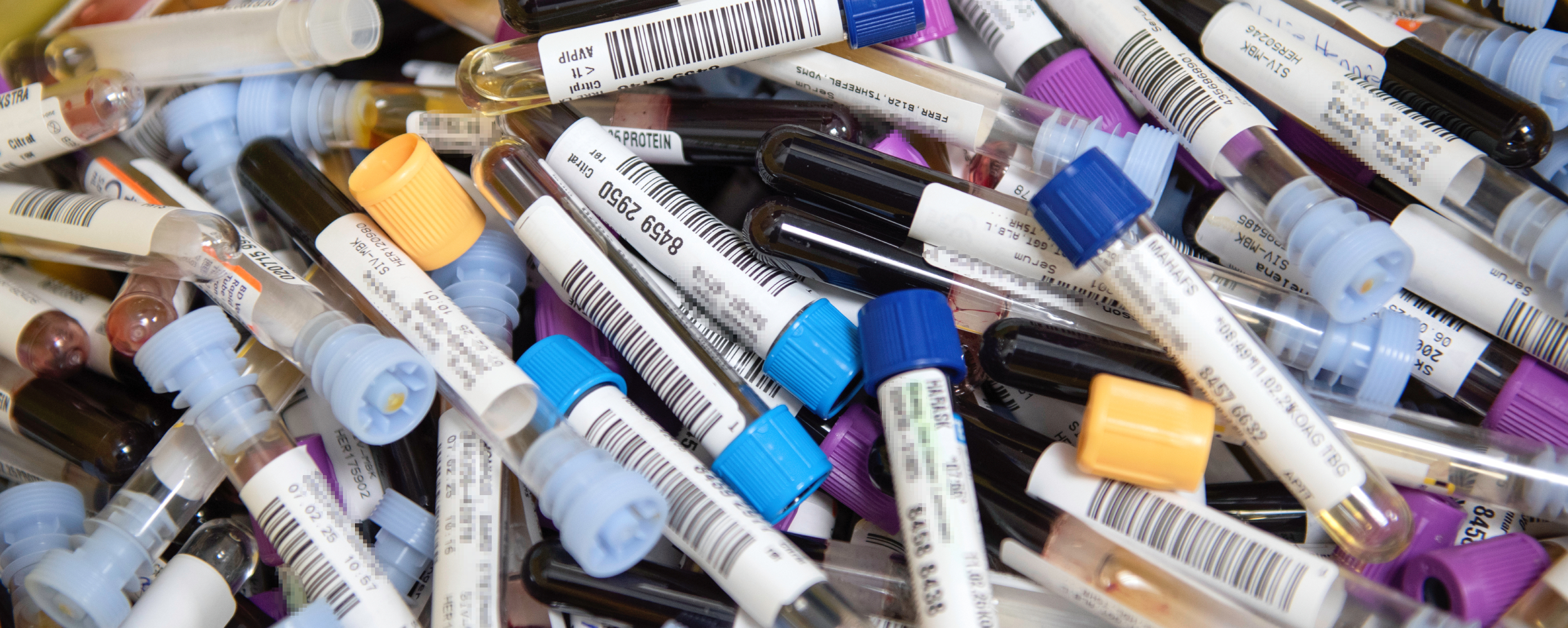 The photo shows a collection of blood sample tubes with different colored caps, each with a label and barcode for identification