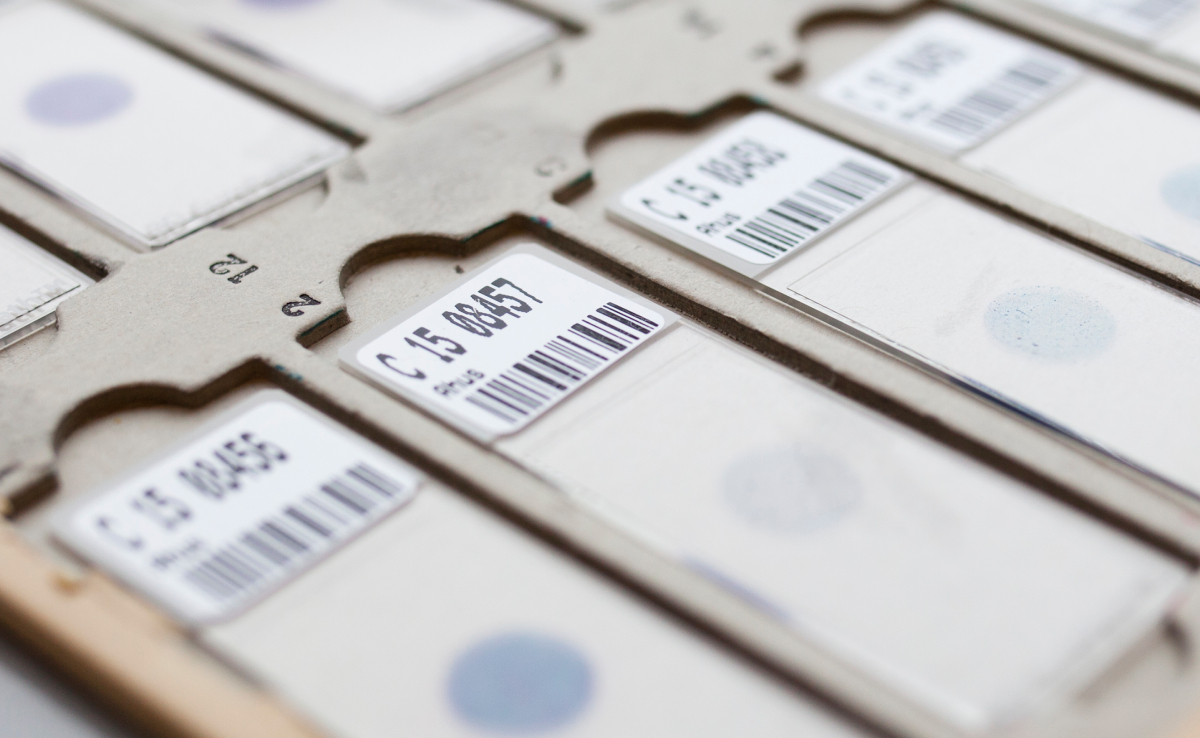 The image shows a close study of several slides used in laboratories, especially in pathology.