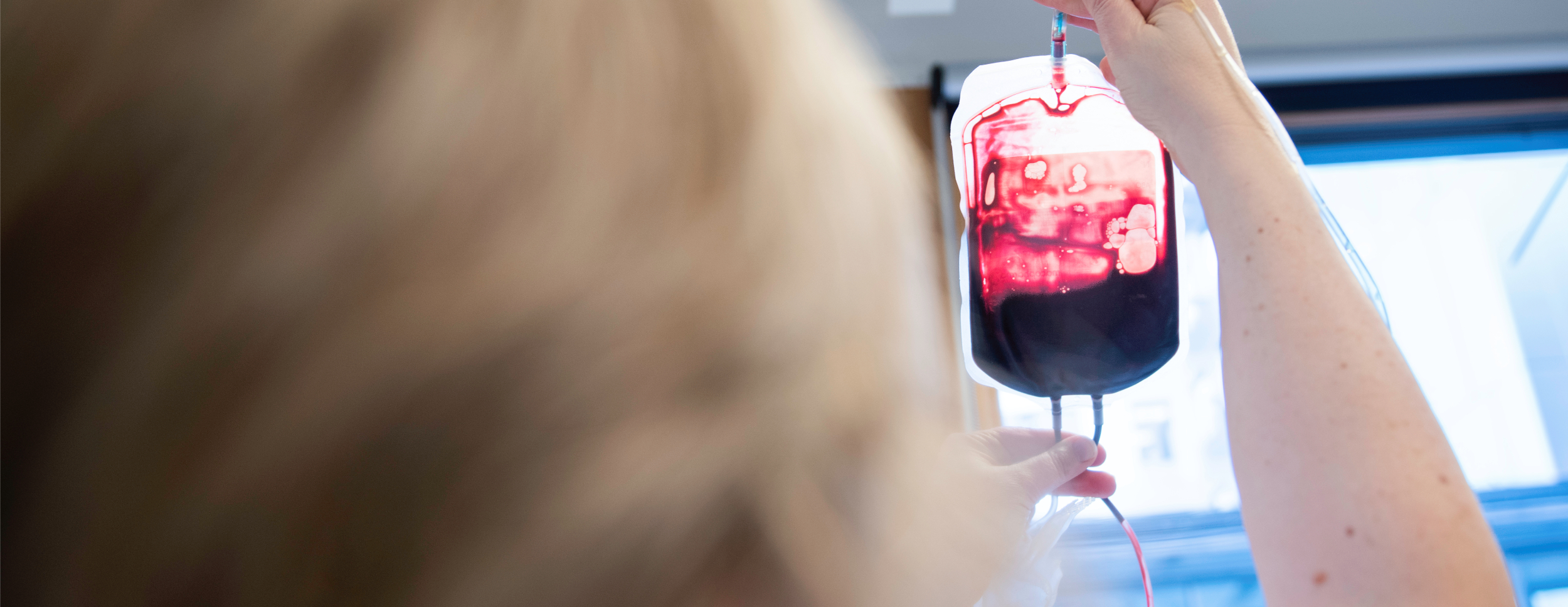 The image shows a person holding up a bag of blood in a clinical or hospital setting.