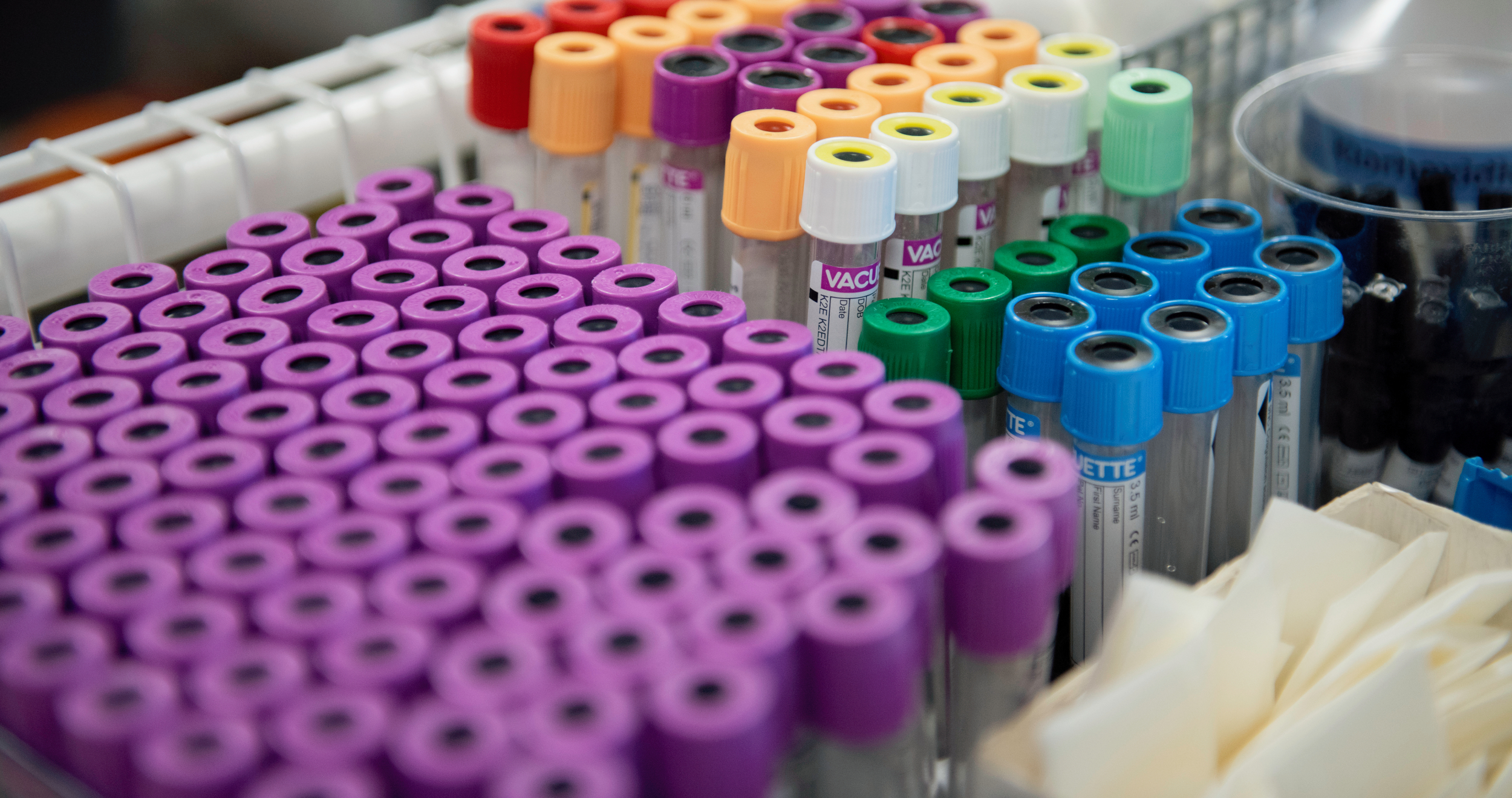 Colourful blood test tubes in racks: purple, orange, green and blue, ready for use in laboratory analysis.